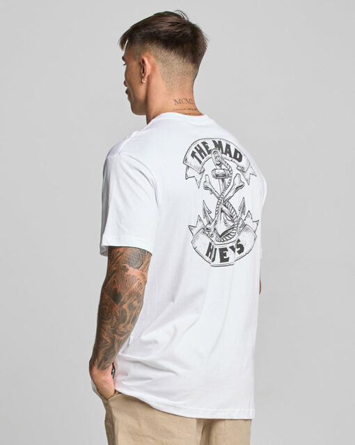 ANCHOR BONES